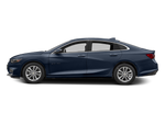 2017 Chevrolet Malibu LT 1LT